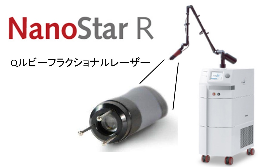 Qスイッチ・ルビーレーザー　NanoStar R